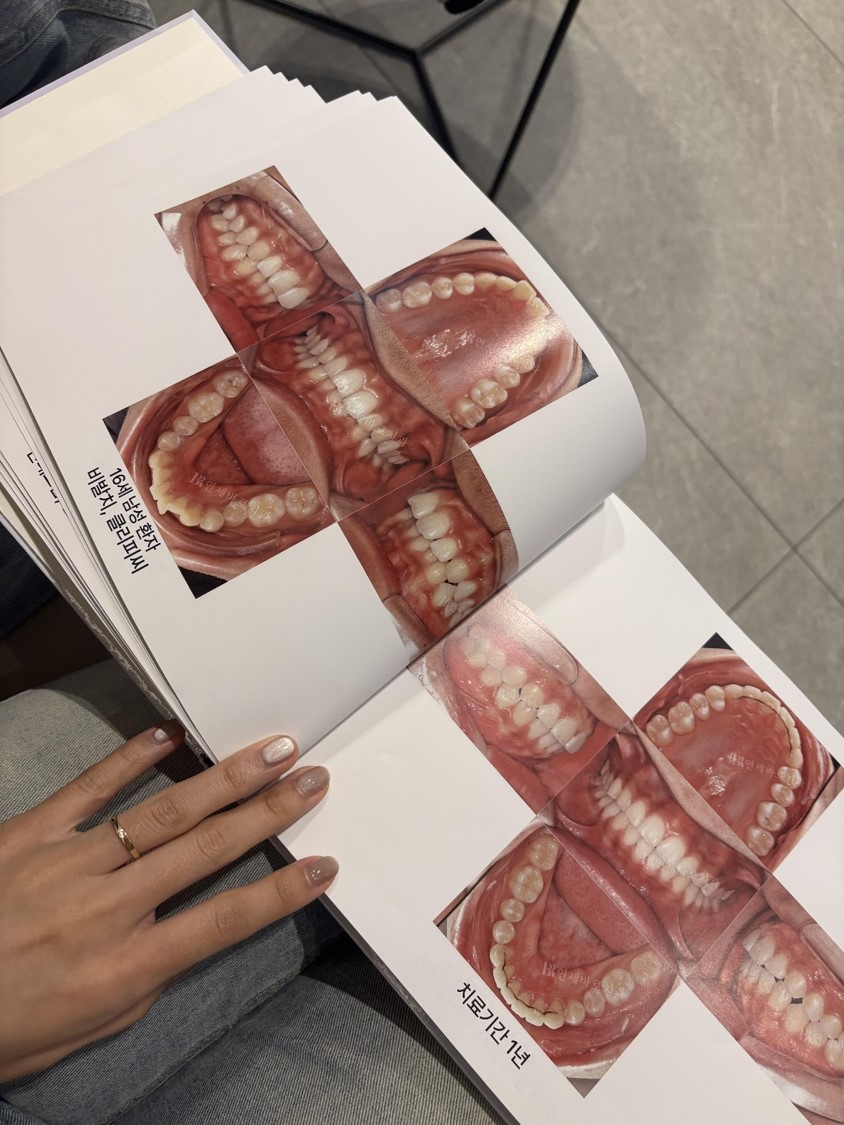 동탄 연세바로치과에 다녀왔습니다!