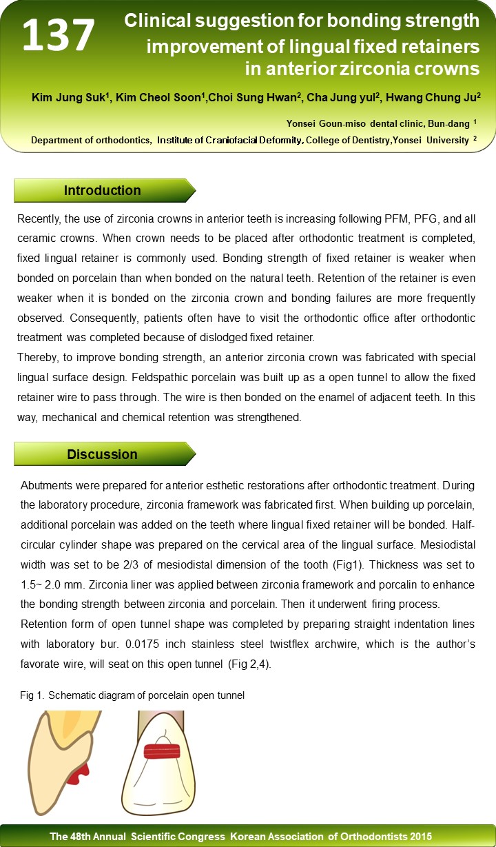 앞니 지르코니아 크라운에서 고정식 유지장치가 잘 떨어지지 않게 하는 방법 (Clinical suggestio…