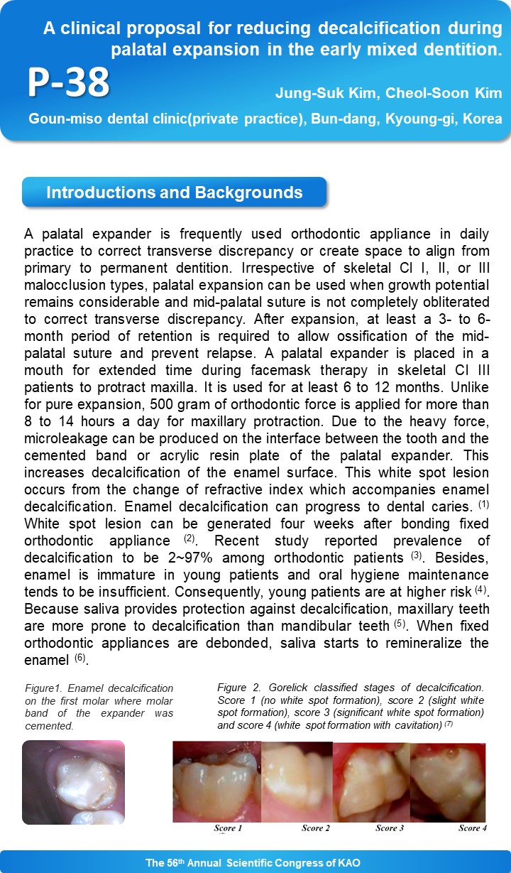 혼합치열 초기 구개 확장 시 탈회(백색 반점)를 줄이는 방법 (A clinical proposal for r…