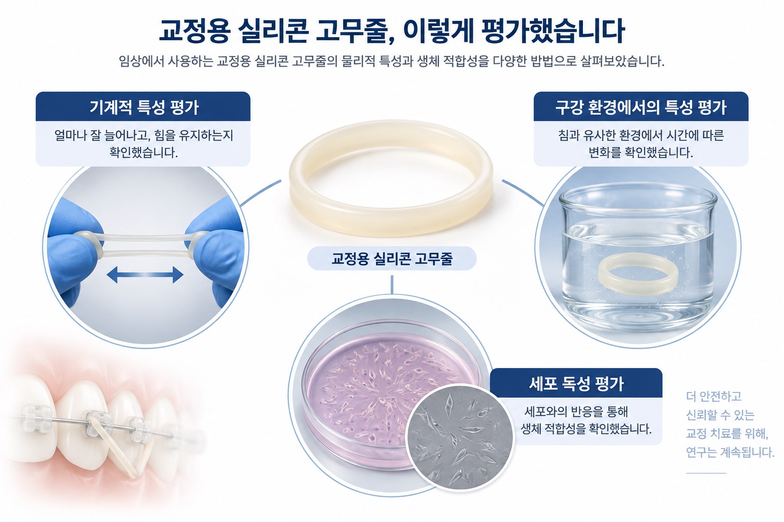 교정용 실리콘 고무 밴드의 임상적·물리적 특성과 세포독성 (A study of the clinical, physical properties and cytotoxicity about the silicone rubber bands)